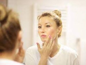 Oily Skin से हो गए हैं परेशान तो आजमाकर देखें ये टिप्स, धूप में भी चेहरे पर दिखेगा निखार