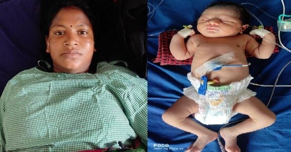 सीएमएचओ डॉ शैलेन्द्र कुमार मंडल की तत्परता से बैगा आदिवासी जच्चा का कराया गया सफल सिजेरियन