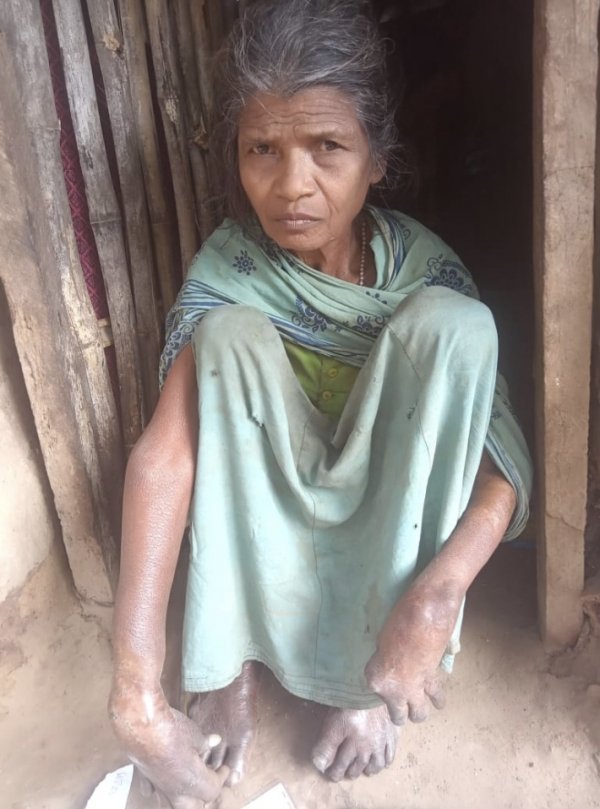 काग़ज़ों में हटाई गई, ज़मीन पर भूखी: विकलांग महिला राशन से वंचित