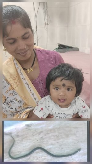 9 माह की बच्ची ने कैरेत साँप को चबाया, साँप की हुई मौत, बच्ची सुरक्षित